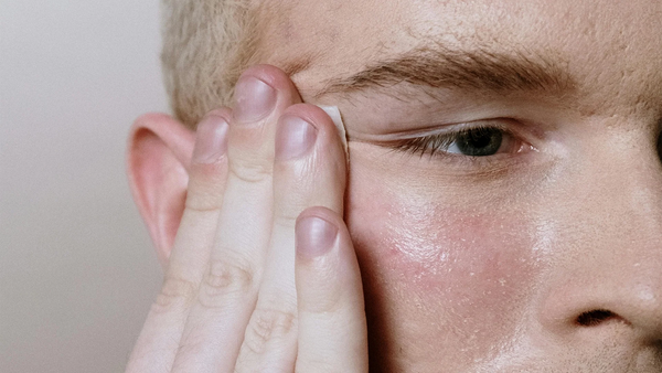 Hormonal Acne Solution: Turmeric's Natural Benefits