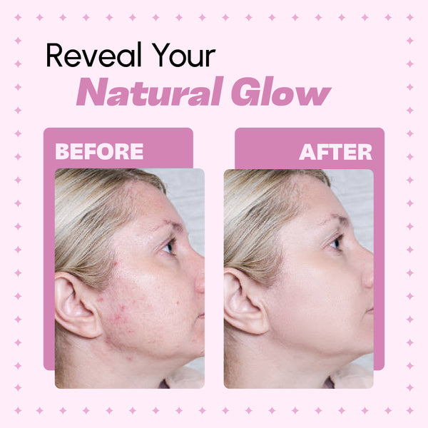 Golden Turmeric Clay Face Mask