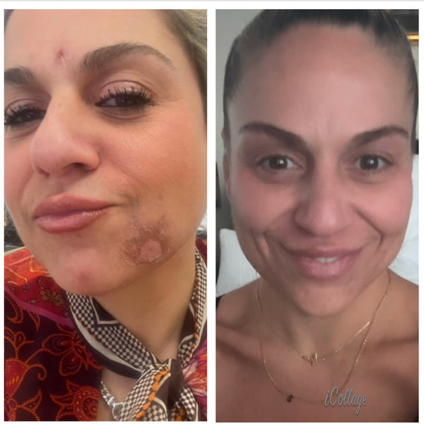 The Glow-Getter Golden Turmeric Clay Face Mask Bundle