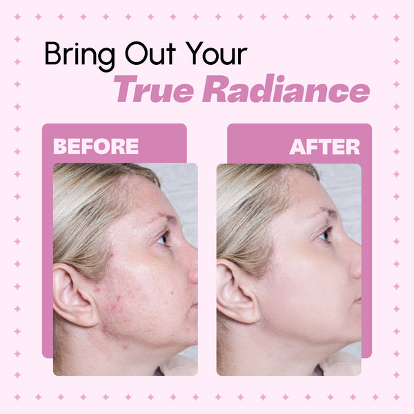 Golden Turmeric Clay Face Mask